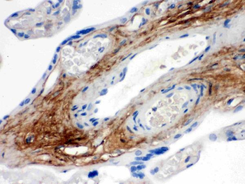 Anti-TNXB Antibody