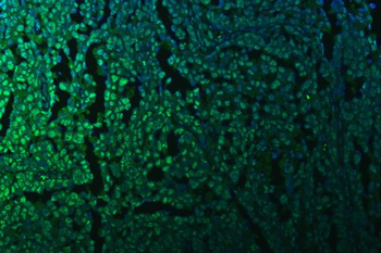 Anti-KAP1/TRIM28 Antibody