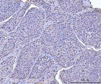 Anti-KAP1/TRIM28 Antibody
