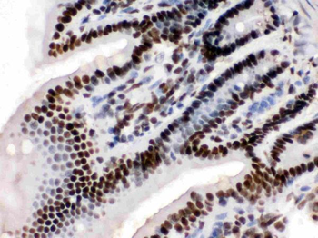 Anti-KAP1/TRIM28 Antibody
