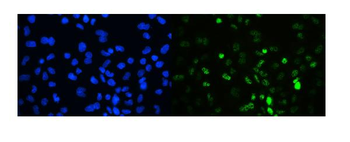 Anti-TIF1 gamma/TRIM33 Antibody