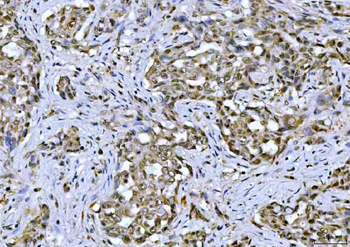 Anti-TIF1 gamma/TRIM33 Antibody