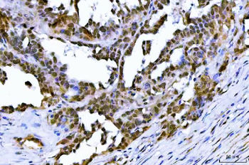 Anti-TIF1 gamma/TRIM33 Antibody