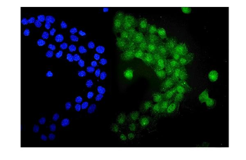 Anti-UBE1C/UBA3 Antibody