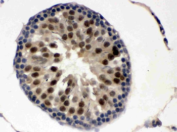 Anti-UBE1C/UBA3 Antibody