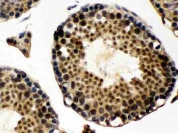 Anti-UBE1C/UBA3 Antibody