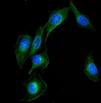 Anti-UBE2Q2 Antibody