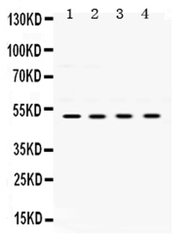 Anti-UBE2Q2 Antibody