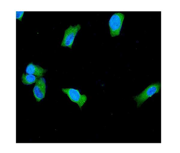 Anti-PGP9.5/UCHL1 Antibody