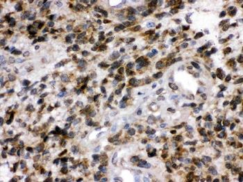 Anti-PGP9.5/UCHL1 Antibody