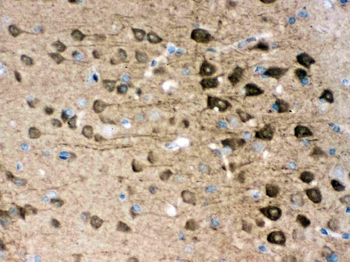 Anti-PGP9.5/UCHL1 Antibody