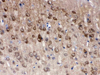 Anti-PGP9.5/UCHL1 Antibody