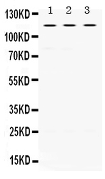 Anti-UNC5C Antibody