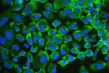 Anti-RENT1/hUPF1 Antibody
