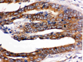 Anti-RENT1/hUPF1 Antibody