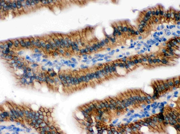 Anti-RENT1/hUPF1 Antibody