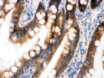 Anti-RENT1/hUPF1 Antibody