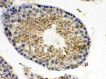 Anti-UPF3B/RENT3B Antibody