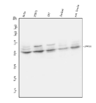 Anti-UPF3B/RENT3B Antibody