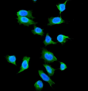 Anti-Galectin 1/LGALS1 Antibody