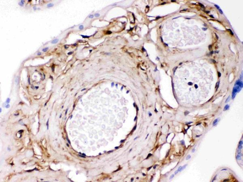 Anti-Galectin 1/LGALS1 Antibody