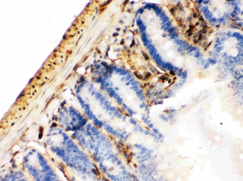 Anti-Galectin 1/LGALS1 Antibody