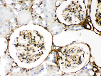 Anti-Galectin 1/LGALS1 Antibody