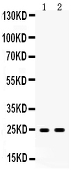 Anti-Apolipoprotein A I/APOA1 Antibody