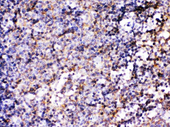 Anti-BCAR3 Antibody