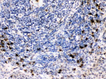 Anti-BCAR3 Antibody