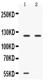 Anti-Ceruloplasmin/CP Antibody