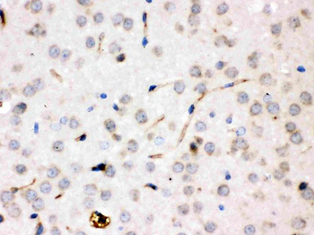 Anti-Ceruloplasmin/CP Antibody