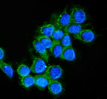 Anti-Cathepsin D/CTSD Antibody