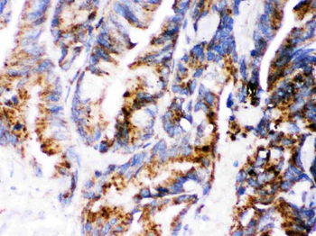 Anti-Cathepsin D/CTSD Antibody