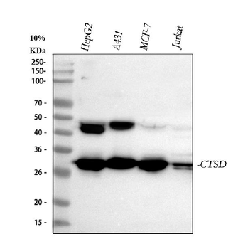 Anti-Cathepsin D/CTSD Antibody