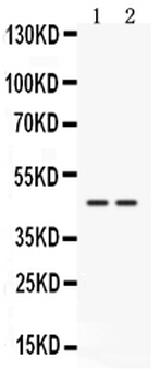 Anti-Cathepsin K/CTSK Antibody