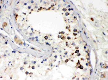 Anti-Smac/Diablo Antibody