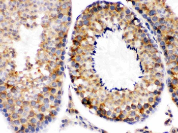 Anti-Smac/Diablo Antibody