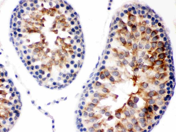 Anti-Smac/Diablo Antibody