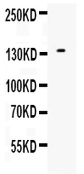 EGF Rabbit Polyclonal Antibody