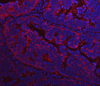 Anti-Fatty Acid Synthase/FASN Antibody