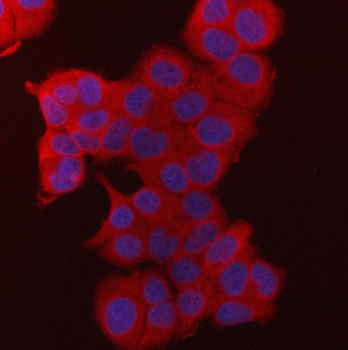 Anti-Fatty Acid Synthase/FASN Antibody