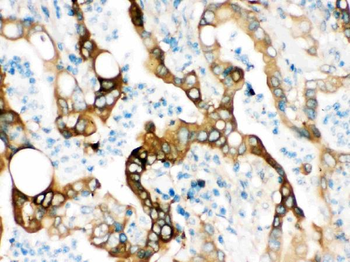 Anti-Fatty Acid Synthase/FASN Antibody