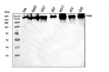 Anti-Fatty Acid Synthase/FASN Antibody