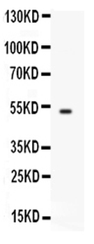 Anti-FCGRT Antibody