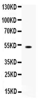 Anti-FCGRT Antibody
