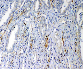 Anti-VEGFD/FIGF Antibody