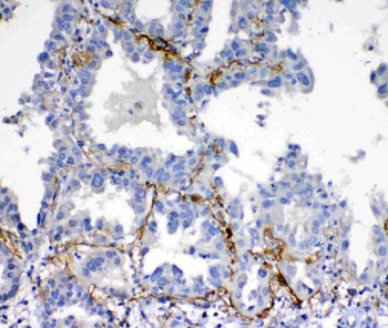 Anti-VEGFD/FIGF Antibody