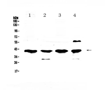 Anti-VEGFD/FIGF Antibody