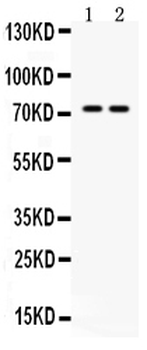 Anti-MDMX/MDM4 Antibody
